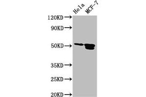 Western Blot Positive WB detected in: Hela whole cell lysate, MCF-7 whole cell lysate All lanes: TFAP2B antibody at 3. (TFAP2B anticorps  (AA 111-208))