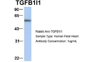 Host:  Rabbit  Target Name:  TGFB1I1  Sample Type:  Human Fetal Heart  Antibody Dilution:  1.