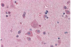 Human Brain, Cortex: Formalin-Fixed, Paraffin-Embedded (FFPE)