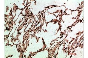Immunohistochemical analysis of paraffin-embedded human-lung, antibody was diluted at 1:200 (ADI1 anticorps  (AA 71-120))
