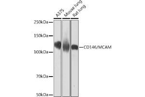 Western blot analysis of extracts of various cell lines, using CD146/MCAM Rabbit mAb (ABIN7268460) at 1:1000 dilution. (MCAM anticorps)