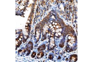 IHC analysis of Rab4/RAB4A using anti-Rab4/RAB4A antibody (ABIN7599733). (Rab4 anticorps  (AA 110-216))