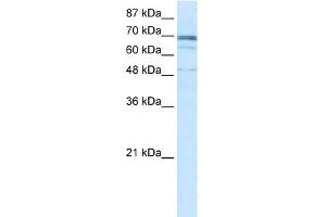 WB Suggested Anti-ZNF614 Antibody Titration:  0. (ZNF614 anticorps  (N-Term))