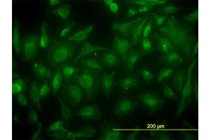Immunofluorescence of monoclonal antibody to CKB on HeLa cell.
