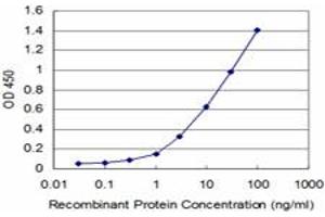 Detection limit for recombinant GST tagged CARF is approximately 1ng/ml as a capture antibody. (CDKN2AIP anticorps  (AA 1-579))