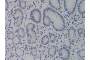 DAB staining on IHC-P; Samples: Human Stomach Tissue