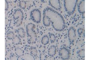 DAB staining on IHC-P; Samples: Human Stomach Tissue (CYP24A1 anticorps  (AA 37-250))
