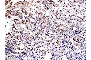 Formalin-fixed and paraffin embedded rat esophagus labeled with Anti-SOX2 Polyclonal Antibody, Unconjugated (ABIN669621) at 1:200 followed by conjugation to the secondary antibody and DAB staining