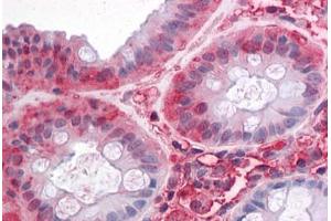 Human Colon: Formalin-Fixed, Paraffin-Embedded (FFPE) (SLC1A5 anticorps  (Internal Region))