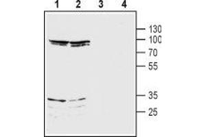 anti-Glutamate Receptor, Ionotropic, N-Methyl D-Aspartate 3B (GRIN3B) (AA 363-376), (Extracellular) antibody
