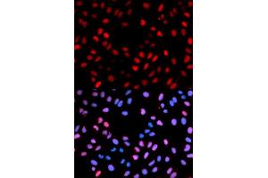 Immunofluorescence analysis of U2OS cells using Phospho-RAF1-S621 antibody (ABIN5969931). (RAF1 anticorps  (pSer621))