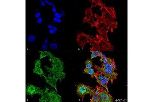 Immunocytochemistry/Immunofluorescence analysis using Mouse Anti-GFAP Monoclonal Antibody, Clone S206A-8 . (GFAP anticorps  (AA 411-422) (Atto 594))