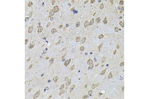 Immunohistochemistry of paraffin-embedded mouse brain using NFU1 Antibody (ABIN2564134) at dilution of 1:100 (40x lens). (NFU1 anticorps)