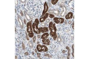 Immunohistochemical staining of human kidney shows strong cytoplasmic and luminal positivity in tubular cells. (PDZK1 anticorps)