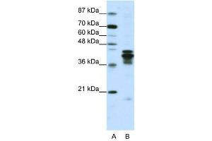WB Suggested Anti-HNRPD  Antibody Titration: 1.