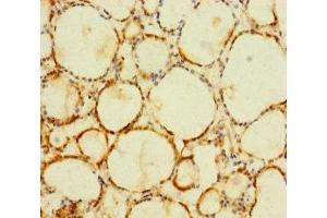 Immunohistochemistry of paraffin-embedded human thyroid tissue using ABIN7174776 at dilution of 1:100 (C1orf112 anticorps  (AA 301-530))