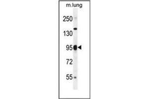 Western blot analysis of PAPR9 Antibody (C-term) in mouse lung tissue lysates (35ug/lane). (PARP9 anticorps  (C-Term))