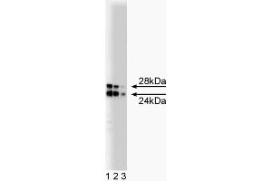 Western Blotting (WB) image for anti-Catechol-O-Methyltransferase (COMT) (AA 26-141) antibody (ABIN968704) (COMT anticorps  (AA 26-141))