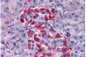 Human Pancreas (formalin-fixed, paraffin-embedded) stained with BID antibody ABIN343922 at 5 ug/ml followed by biotinylated goat anti-rabbit IgG secondary antibody ABIN481713, alkaline phosphatase-streptavidin and chromogen. (BID anticorps)