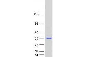 Validation with Western Blot