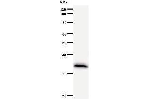 Western Blotting (WB) image for anti-Calcium And Integrin Binding Family Member 2 (CIB2) antibody (ABIN930952) (CIB2 anticorps)