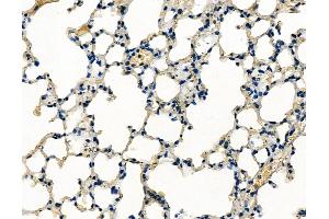 ABIN6260447 and ABIN6279233 at 1/100 staining mouse lung tissue by IHC-P. (CAPN13 anticorps  (N-Term))