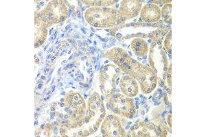 Immunohistochemistry of paraffin-embedded rat kidney using NDUFV2 antibody.