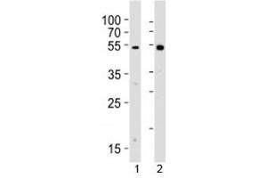 Western blot analysis of lysate from 1) human Raji cell line and 2) rat spleen tissue lysate using Lyn antibody.