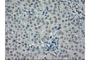 Image no. 2 for anti-NIMA (Never in Mitosis Gene A)-Related Kinase 6 (NEK6) antibody (ABIN1499686)