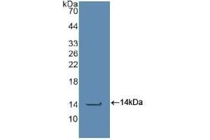 Detection of Recombinant CASP2, Human using Polyclonal Antibody to Caspase 2 (CASP2) (Caspase 2 anticorps  (AA 334-452))