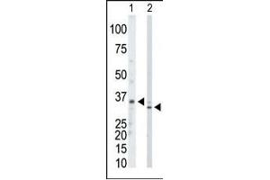 The anti-PRPS1/2/3 Pab (ABIN391076 and ABIN2841223) is used in Western blot to detect PRPS1/2/3 in mouse kidney tissue lysate (Lane 1) and Hela cell lysate (Lane 2). (PRPS1,PRPS2,PRPS3 (AA 79-109), (N-Term) anticorps)