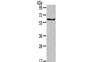 Western Blot analysis of Jurkat cells using GLP2R Polyclonal Antibody at dilution of 1:400 (GLP2R anticorps)