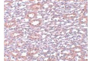 Immunohistochemical staining of rat kidney tissue with PIAS1 polyclonal antibody  at 5 ug/mL dilution. (PIAS1 anticorps  (C-Term))