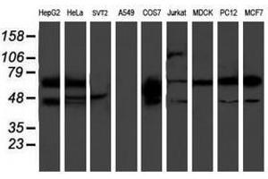 Image no. 4 for anti-phosphodiesterase 1B, Calmodulin-Dependent (PDE1B) antibody (ABIN1500074)