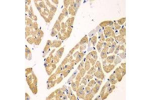 Immunohistochemistry of paraffin-embedded mouse heart using KYNU antibody.