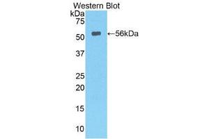 Western Blotting (WB) image for anti-Lipase, Hepatic (LIPC) (AA 103-356) antibody (ABIN1078291) (LIPC anticorps  (AA 103-356))