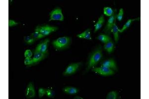 Immunofluorescence staining of Hela cells with ABIN7163303 at 1:100, counter-stained with DAPI. (PIK3IP1 anticorps  (AA 22-168))