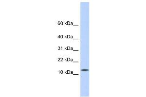 WB Suggested Anti-CDRT4 Antibody Titration: 0. (CDRT4 anticorps  (Middle Region))