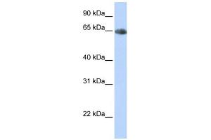 SLC6A2 antibody used at 1 ug/ml to detect target protein.