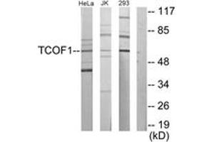 Western Blotting (WB) image for anti-Treacher Collins-Franceschetti Syndrome 1 (TCOF1) (AA 41-90) antibody (ABIN2879146)
