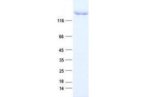 Validation with Western Blot