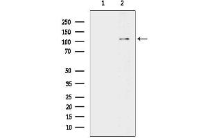 anti-EPH Receptor A6 (Epha6) antibody