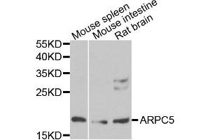 Western blot analysis of extracts of various cells, using ARPC5 antibody. (ARPC5 anticorps)