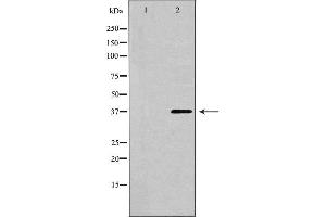 Western blot analysis of extracts of HeLa , using CTGF antibody. (CTGF anticorps  (Internal Region))