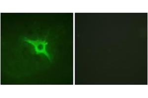 Immunofluorescence (IF) image for anti-Neutrophil Cytosol Factor 1 (NCF1) (AA 301-350) antibody (ABIN2888916) (NCF1 anticorps  (AA 301-350))