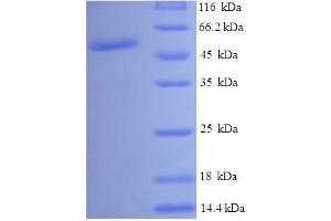 UDP-Galactose-4-Epimerase (GALE) (AA 1-348), (full length) protein (His-SUMO Tag)