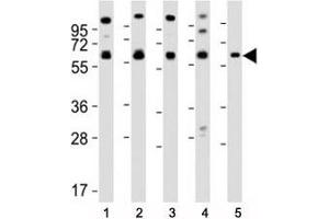 Western blot testing of Pyruvate Kinase antibody at 1:2000 dilution.