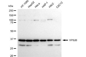 anti-Vacuolar Protein Sorting-Associated Protein 26A (VPS26A) antibody