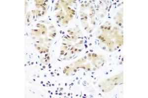 Immunohistochemistry of paraffin-embedded human stomach using AGO2 antibody (ABIN5973585) at dilution of 1/100 (40x lens). (AGO2 anticorps)