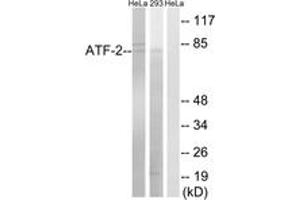 Western blot analysis of extracts from HeLa/293 cells, using ATF-2 (Ab-472) Antibody.